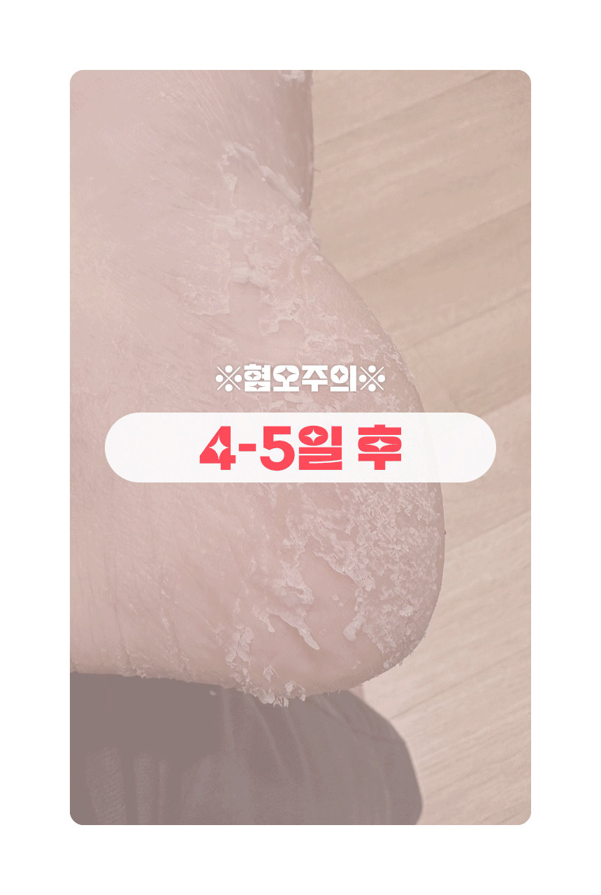 매드포코스_풋필링마스크_02